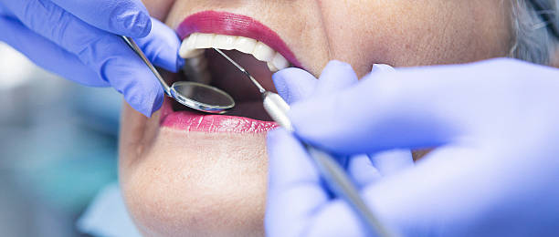 Professional Emergency Dentist in LA